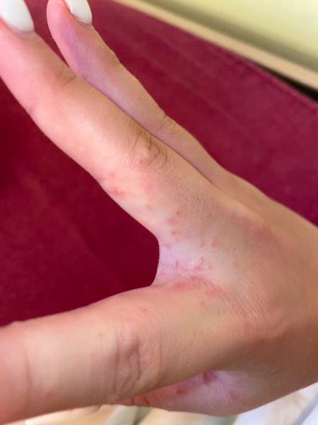 Pupínky. Co by to mohlo být?