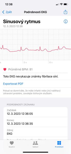 Chápete význam EKG záznamu se sestupným úsekem?