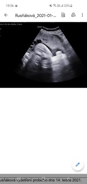 Vidíte tam pohlaví?