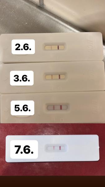 Těhotenský test ukazuje stejné čárky. Je důvod k obavám?
