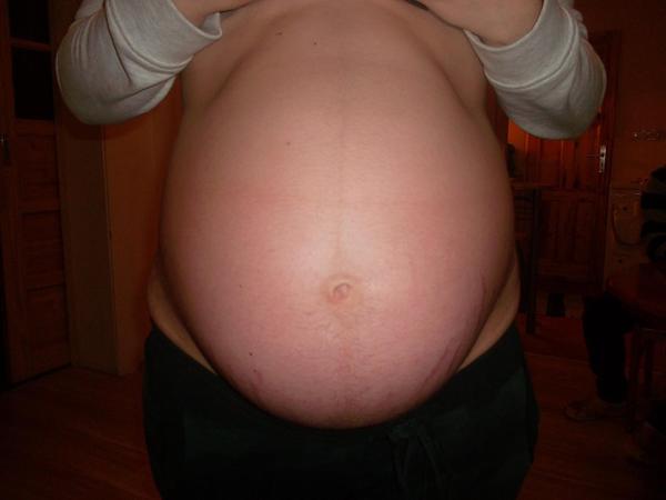 Břicho mi jde ve 32tt čím dál tím víc dolů, poraďte