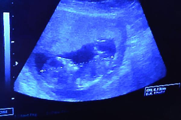 Velikost plodu ve 13. týdnu