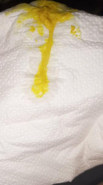 Je to hlenová zátka nebo zbytek léků?