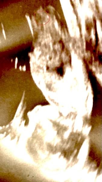 Kdy odhalí ultrazvuk v 17. týdnu pohlaví dítěte?