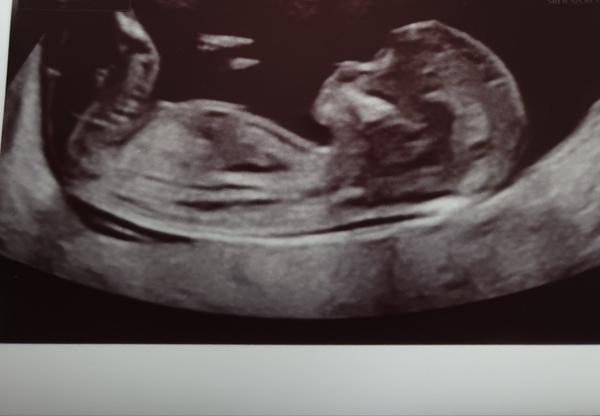 Pohlaví miminka. Poznal byste?