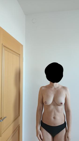 Škaredá prsa a postava typu hruška: Jít na plastiku?