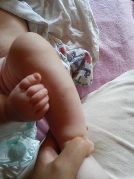 Fialové pupínky, co by to mohlo být?