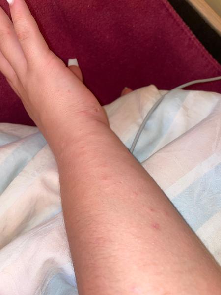 Pupínky. Co by to mohlo být?