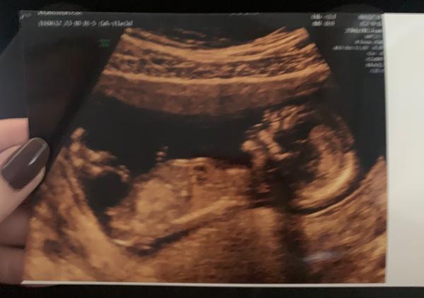 Jde poznat pohlaví?