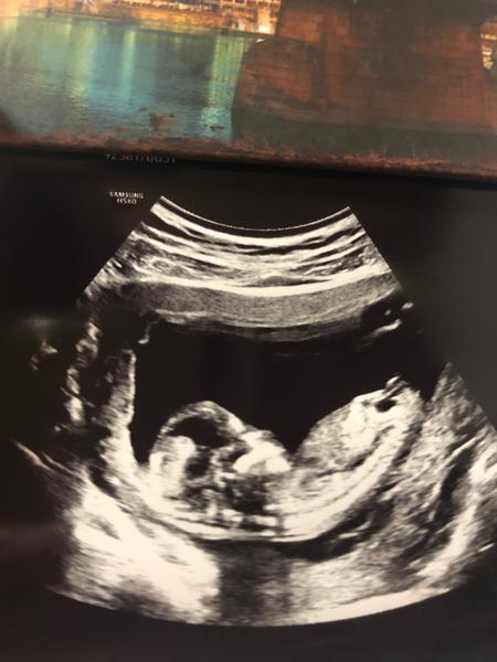 Pohlaví. Holka n. kluk?