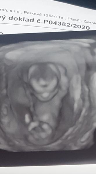 Holka nebo kluk 🙂. Co myslíte?