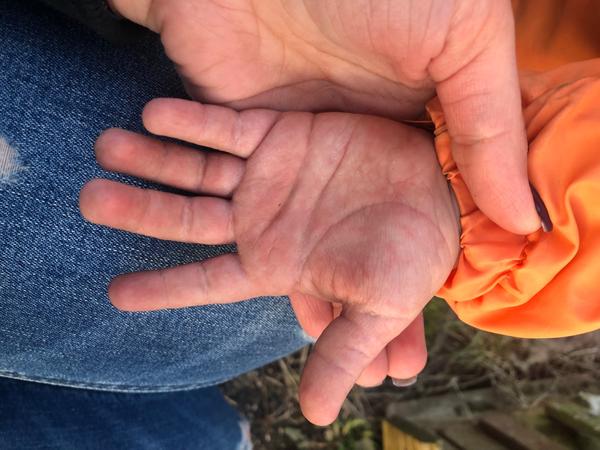 Vyrážka. Co by to mohlo být?