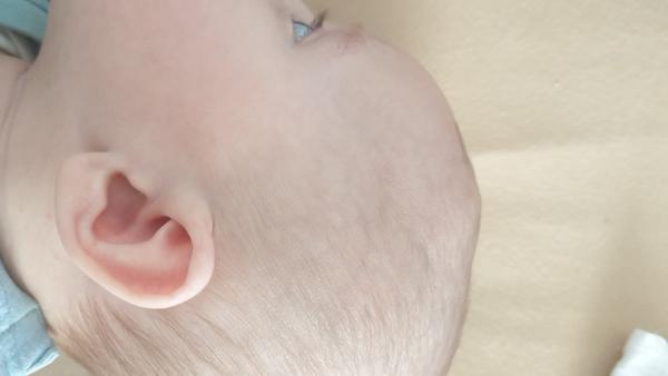 Nerovnost na pravé straně hlavičky a rozdílná velikost zorničky. Zkušenosti 🙏?