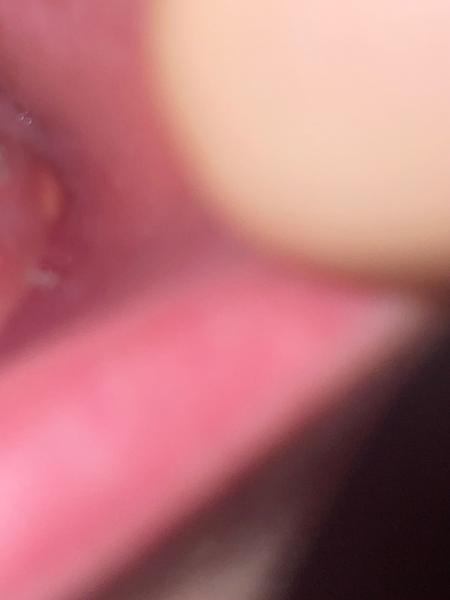 Jak zvládnout otok zubu na dovolené?