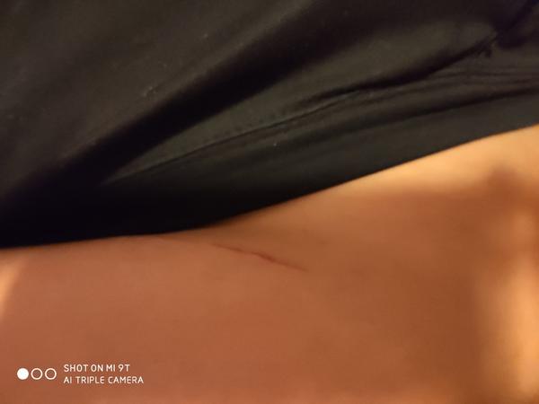 Příznaky. Jsem těhotná?