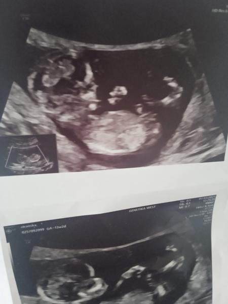 Máme dceru nebo syna? Jak to zjistit?