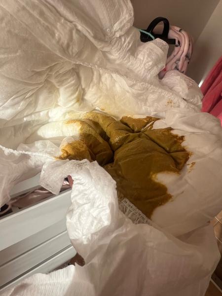 Řídká stolice u miminka na umělé výživě. Je to normální?