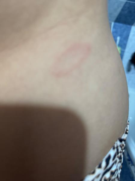 Flek. Co by to mohlo být?