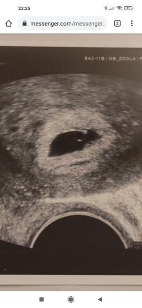 Miminko 5. - 6.tt. Není moc malinké?