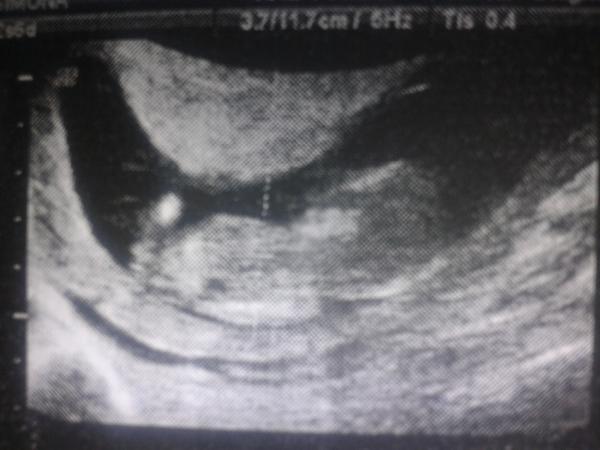 Poznáte na fotce z UTZ, jestli je to kluk nebo holka?