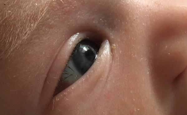 Rudé oko. Co by to mohlo být?