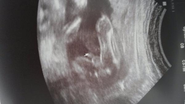 Kluk nebo holka? Asi kluk!