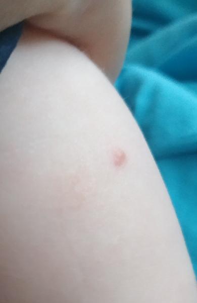 Můžou to být molusky?