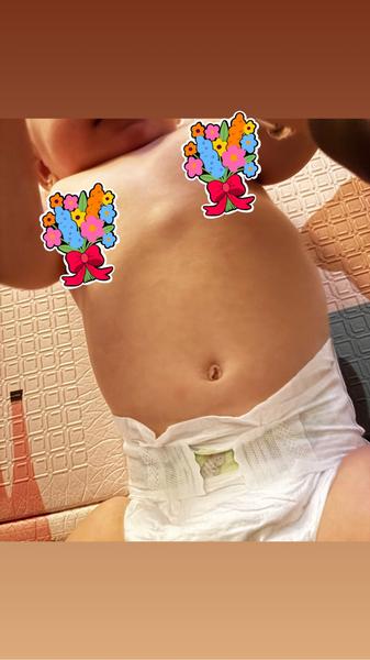 Boule u batolete na hrudi: je to normální?