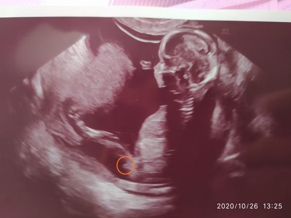 Kluk nebo holka na utz?