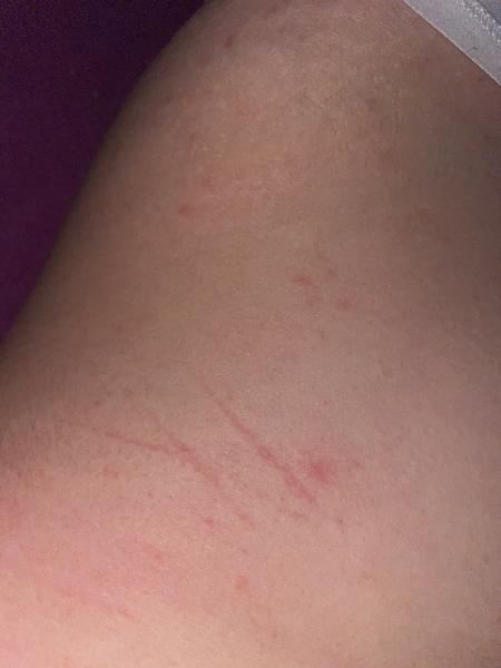 Pupínky. Co by to mohlo být?