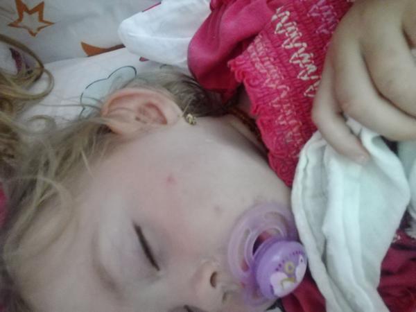 Atopický ekzém? Kvasinky? Co by to mohlo být?