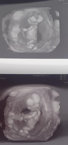 Holka nebo kluk 🙂. Co myslíte?