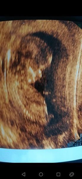 Holka nebo kluk. Poradíte, co to bude?