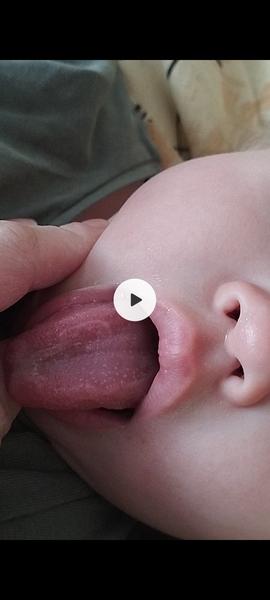 Je bezpečné očkování dítěte při jiných zdravotních problémech?