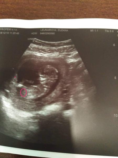 Holka nebo kluk. Vidíte tam něco?