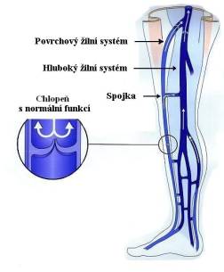 Ambulantní odstranění křečových žil u Mudr. Horákové