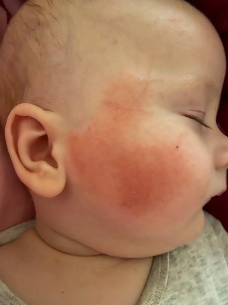 Mohu střídat mast Uriage a Leniens na suchou tvář?