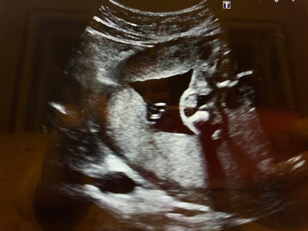 Fotka UTZ. Vidíte tu holku?🙂