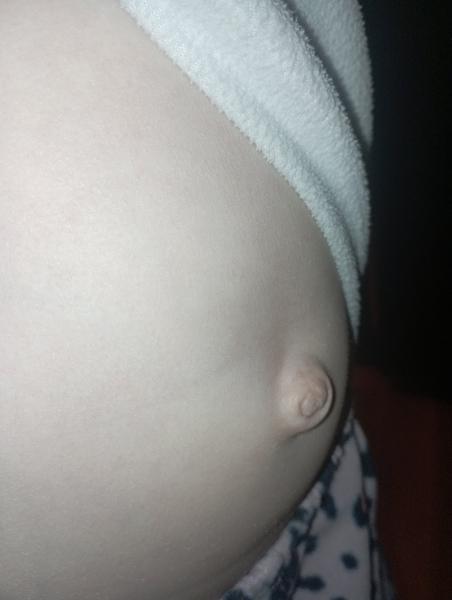 Může to být kýla?