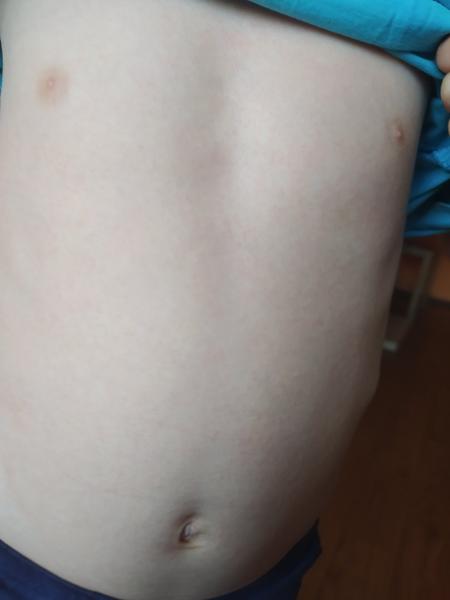 Vyrážka. Co by to mohlo být?