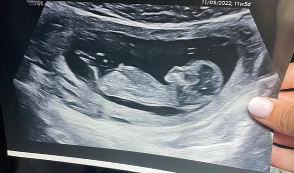 Co myslíte, čekáme chlapce nebo dívku na konci ledna?