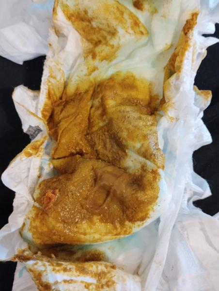 Je tahle stolice normální u 2letého dítěte?