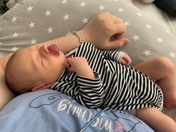 Obrovský hemangiom na kritickém místě - léčba léky