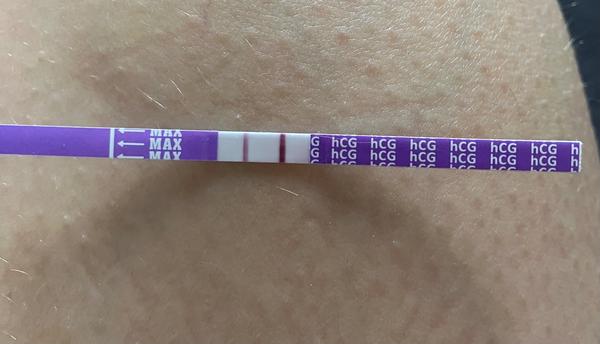 Časté pozitivní těhotenské testy a bolesti břicha. Co dělat?