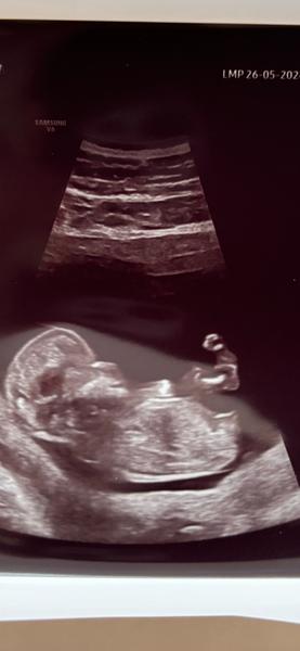 Poznáte prosím pohlaví?