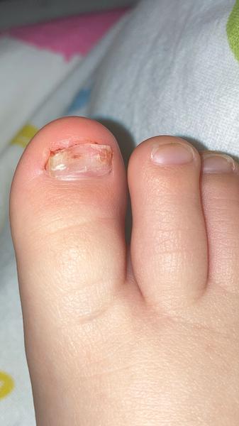 Zkušenosti s doktorem online pro problémy s nehty.