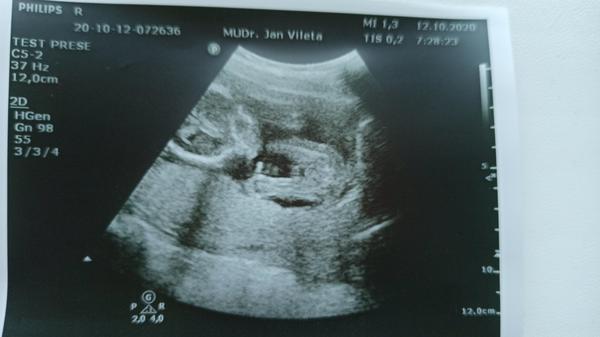 17.tt. Holka nebo kluk? 😃