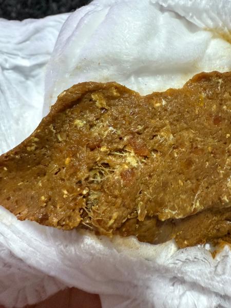 Bílé nitky ve stolici. Jedná se o hlen?