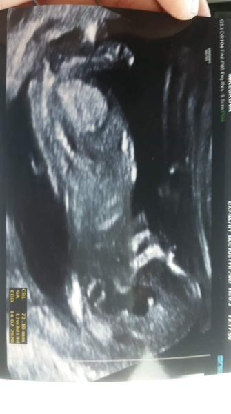 Jde poznat? Holka nebo kluk? (13+2tt)