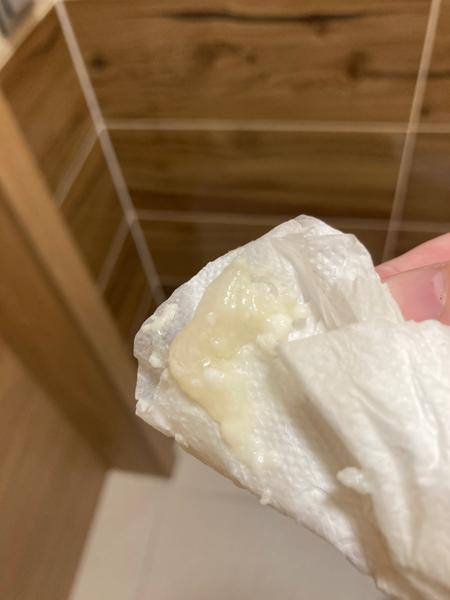 Je to hlenová zátka?